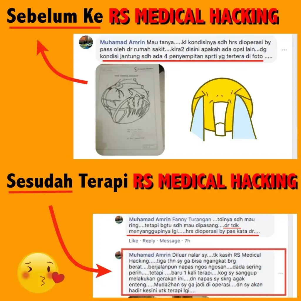 testimoni pasien penyumbatan jantung 100% komplikasi rs medical hacking