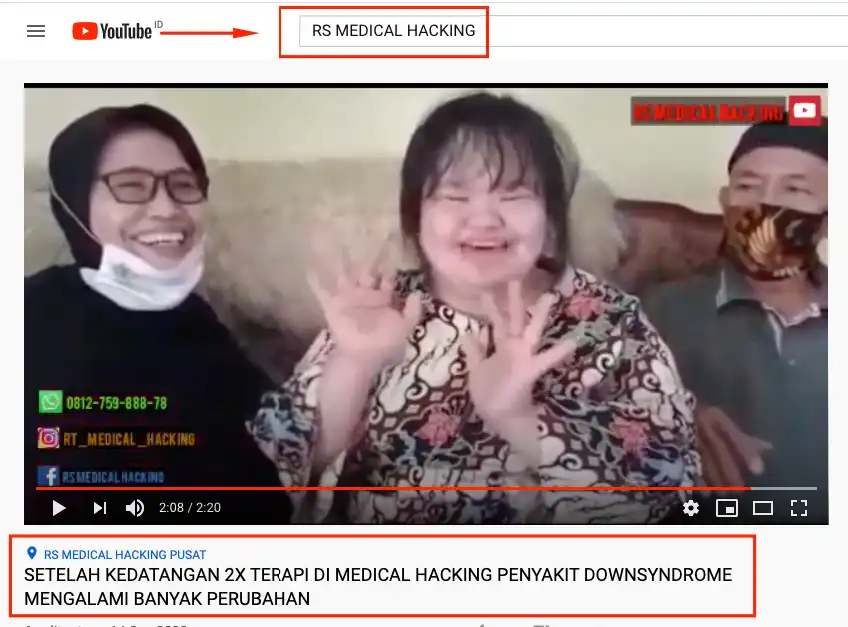 RS MEDICAL HACKING PUSAT TERAPI DOWN SYNDROME TERBAIK NASIONAL