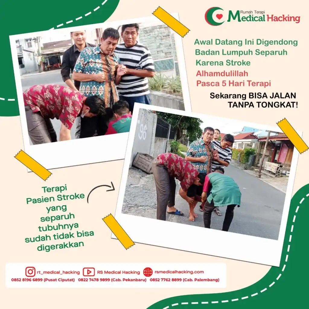 TESTIMONI MEDICAL HACKING PASIEN STROKE